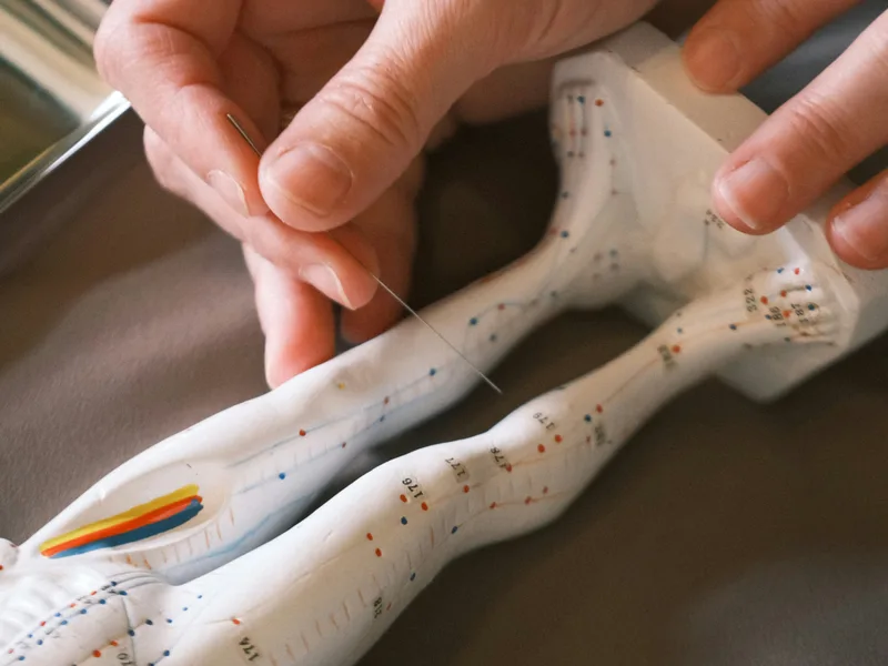 Acupuncture at Hans Chiropractic & Injury Center in Norcross