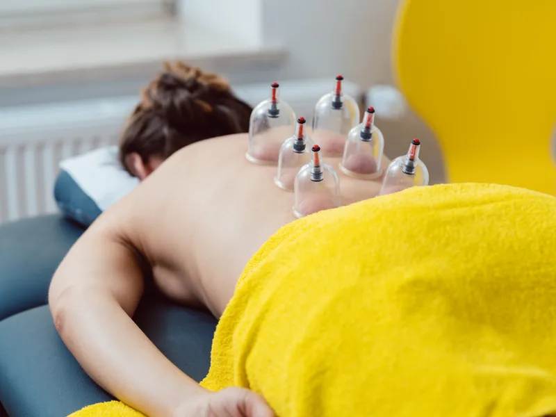Cupping Therapy at Hans Chiropractic & Injury Center in Norcross