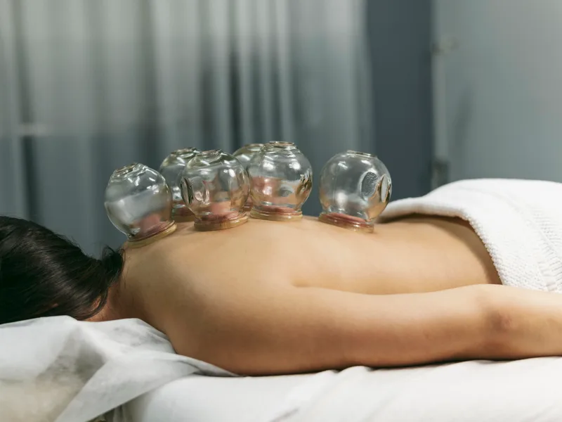 Cupping Therapy at Hans Chiropractic & Injury Center in Norcross