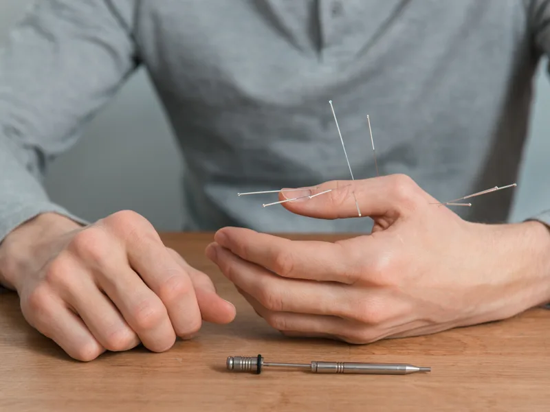 Dry Needling at Hans Chiropractic & Injury Center in Norcross